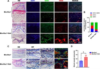 Stabilization of Bio-Oss® particulates using photocurable hydrogel to enhance bone regeneration by regulating macrophage polarization